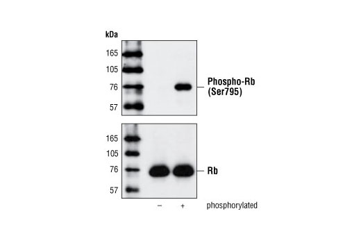 Western Blotting Image 2: Phospho-Rb (Ser795) Antibody