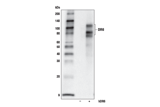 Image 15: Death Receptor Antibody Sampler Kit II