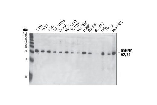 Western Blotting Image 1: hnRNP A2/B1 (2A2) Mouse mAb