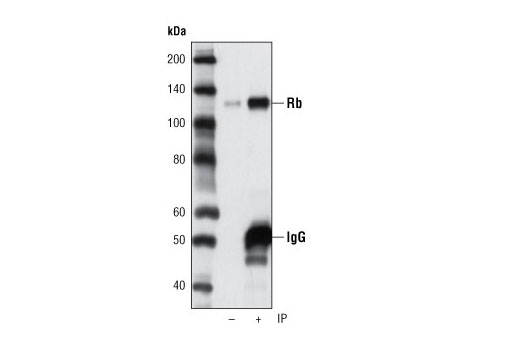Immunoprecipitation Image 1: Rb (D3D2) XP® Rabbit mAb