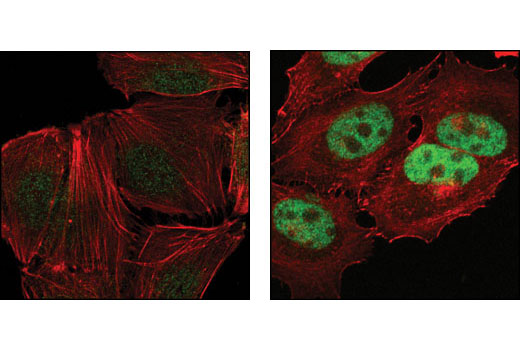 Immunofluorescence Image 1: Rb (D3D2) XP® Rabbit mAb
