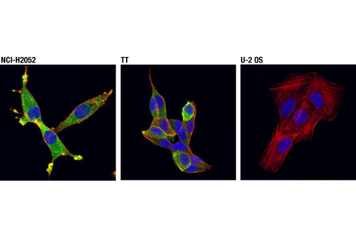 Immunofluorescence Image 1: MTSS1 (D2H4L) XP® Rabbit mAb