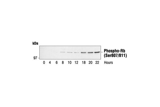 Western Blotting Image 1: Phospho-Rb (Ser807/811) Antibody