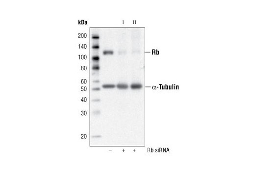  Image 10: Rb Antibody Sampler Kit
