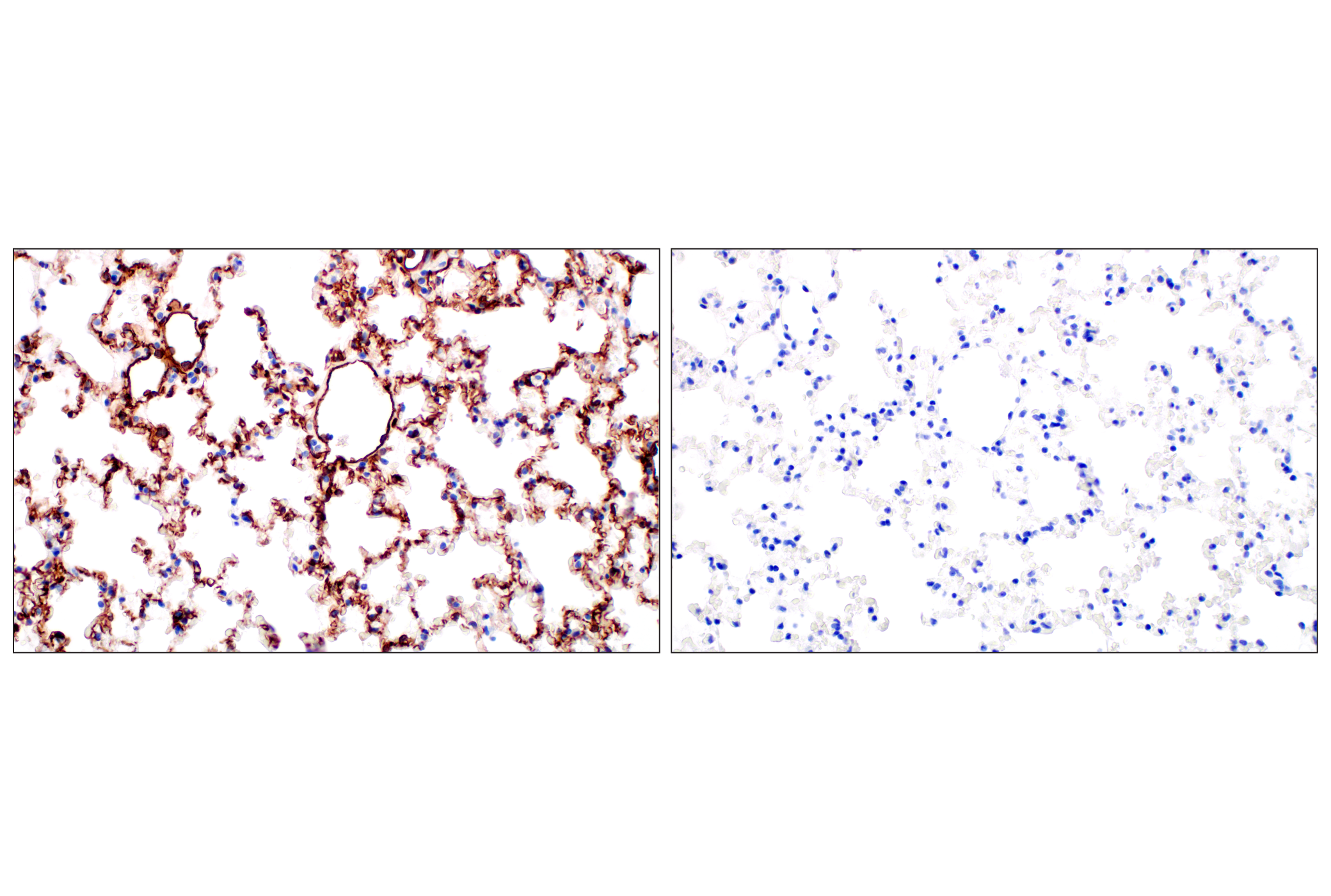 Immunohistochemistry Image 5: LYVE-1 (E5P8S) Rabbit mAb (BSA and Azide Free)
