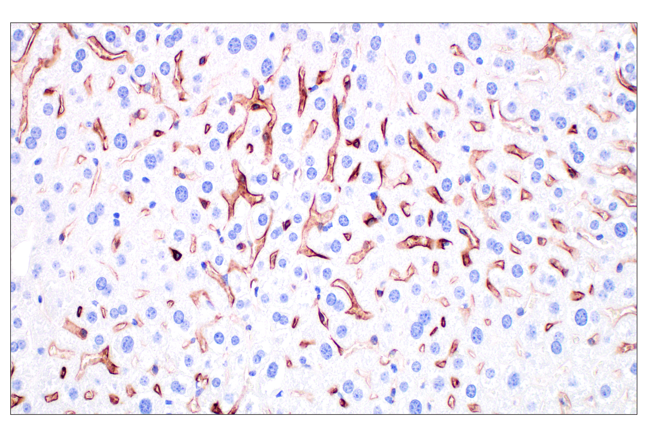 Immunohistochemistry Image 1: LYVE-1 (E5P8S) Rabbit mAb (BSA and Azide Free)
