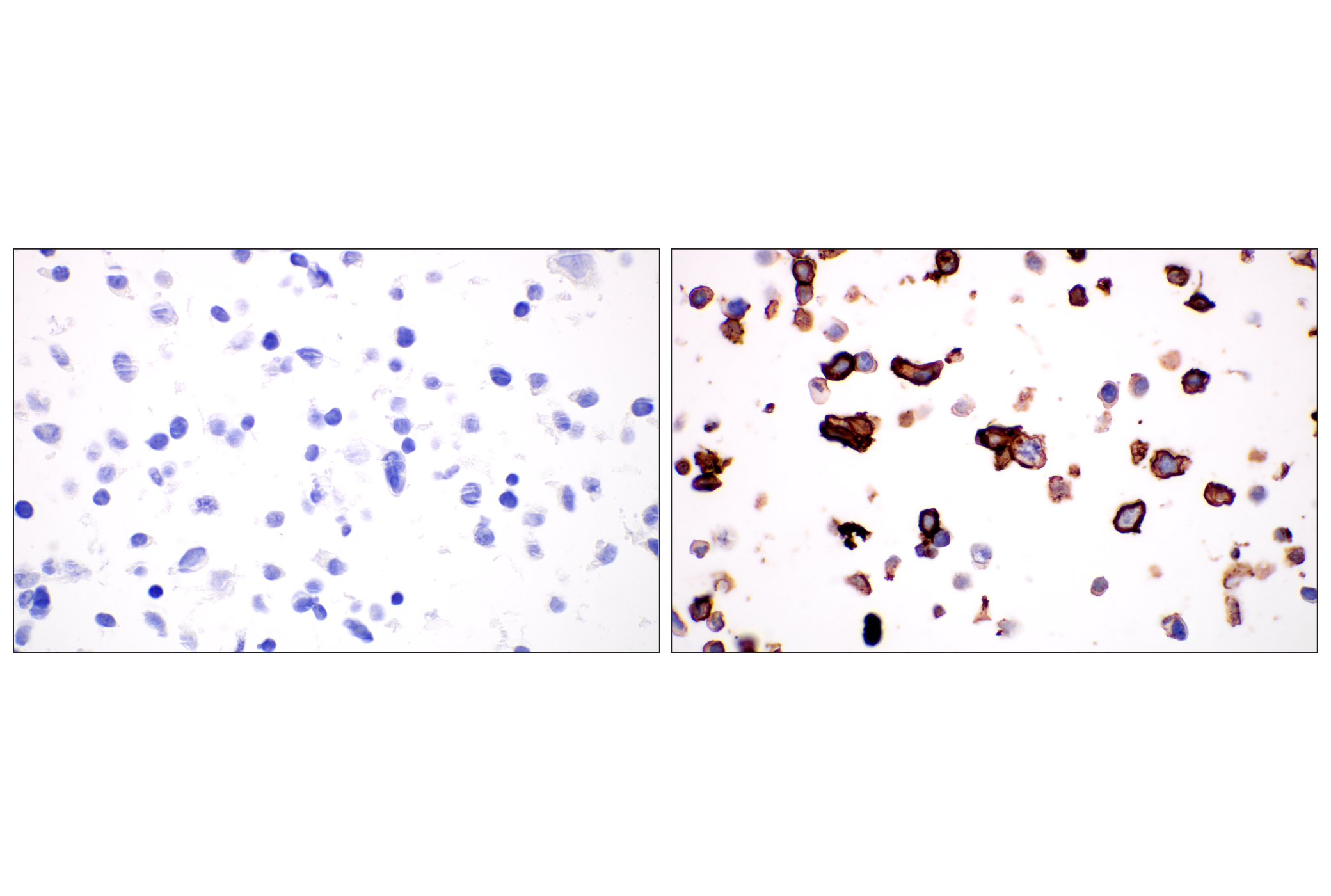 Immunohistochemistry Image 6: LYVE-1 (E5P8S) Rabbit mAb (BSA and Azide Free)