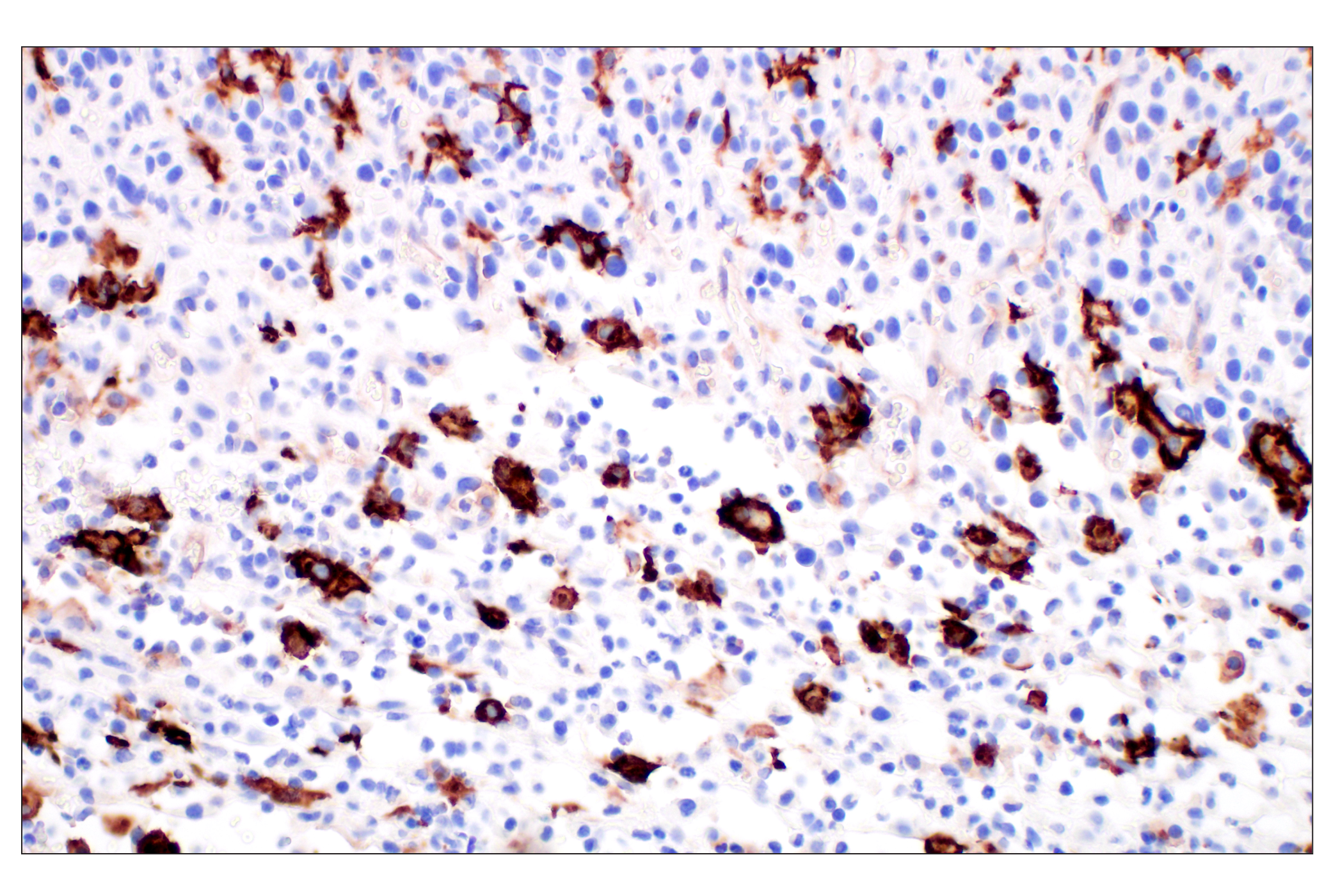Immunohistochemistry Image 4: LYVE-1 (E5P8S) Rabbit mAb (BSA and Azide Free)
