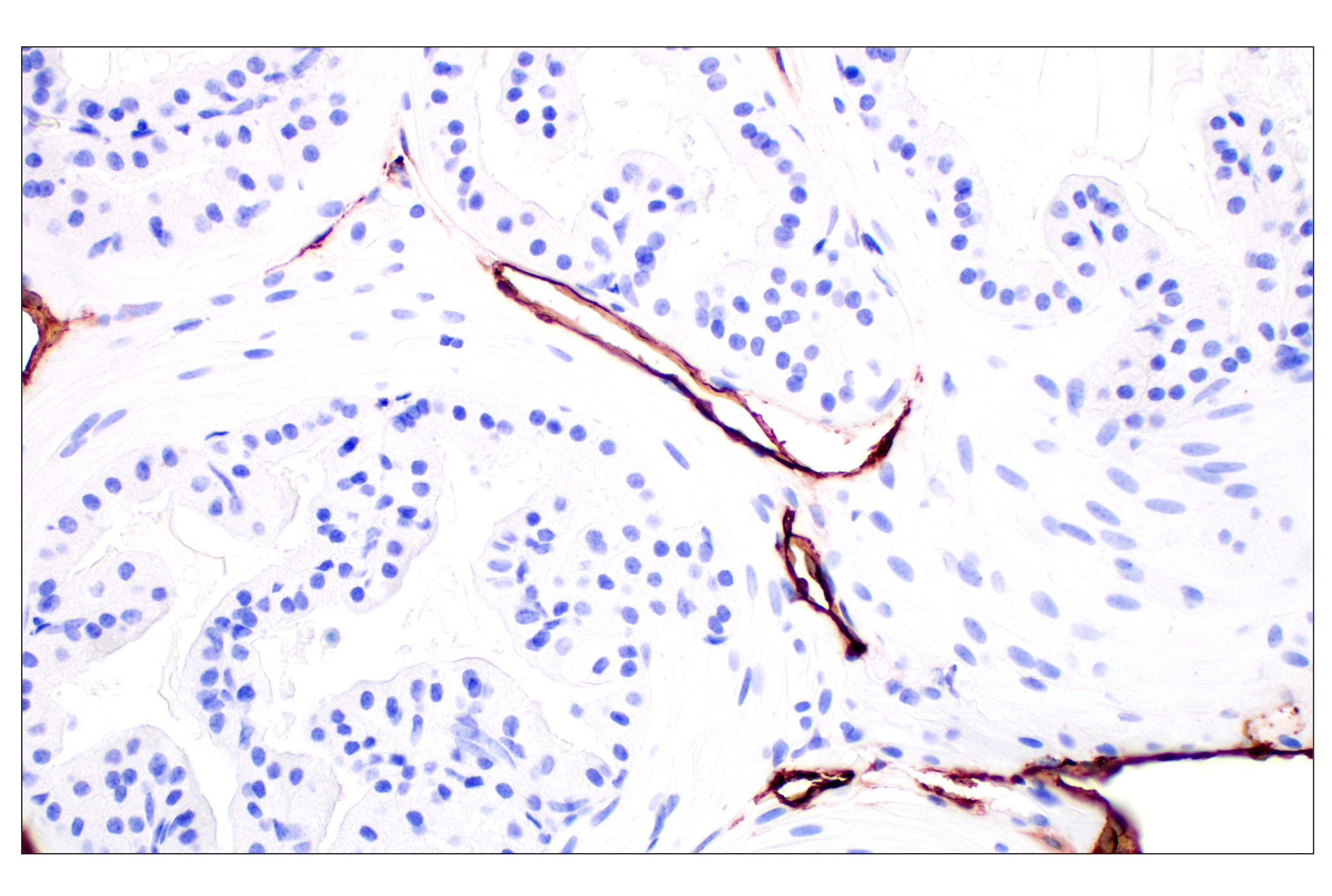 Immunohistochemistry Image 2: LYVE-1 (E5P8S) Rabbit mAb (BSA and Azide Free)