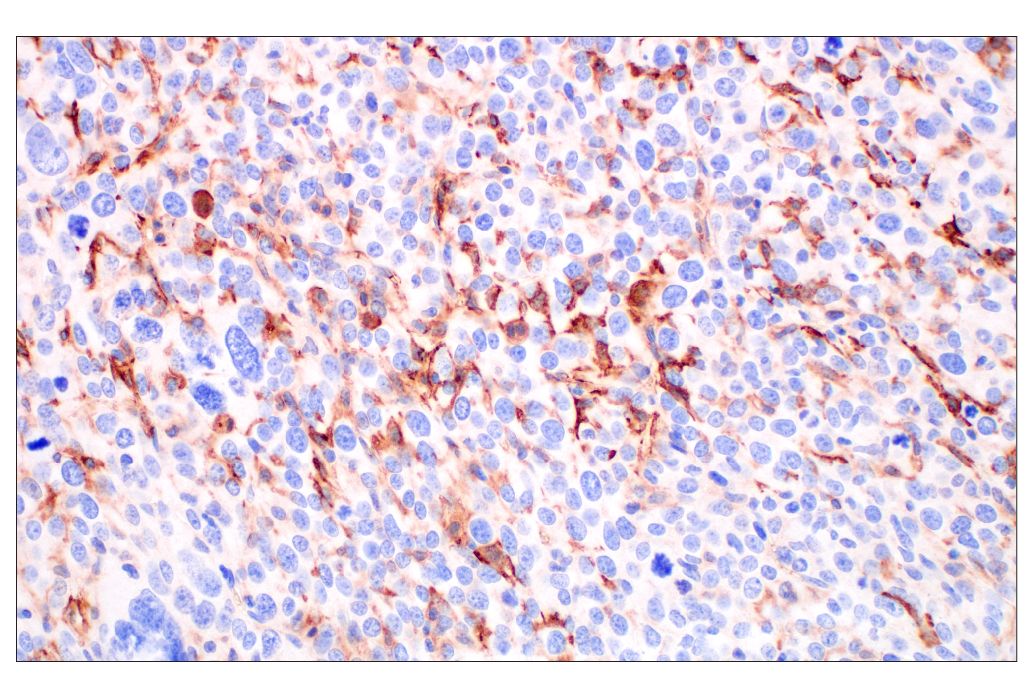 Immunohistochemistry Image 3: LYVE-1 (E5P8S) Rabbit mAb (BSA and Azide Free)