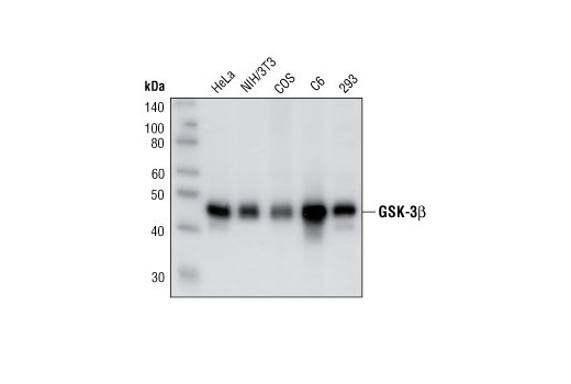 Phospho-GSK-3β (Ser9) (5B3) Rabbit mAb | Cell Signaling Technology
