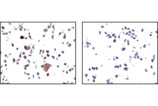 Immunohistochemistry Image 2: Phospho-GSK-3α (Ser21) (36E9) Rabbit mAb