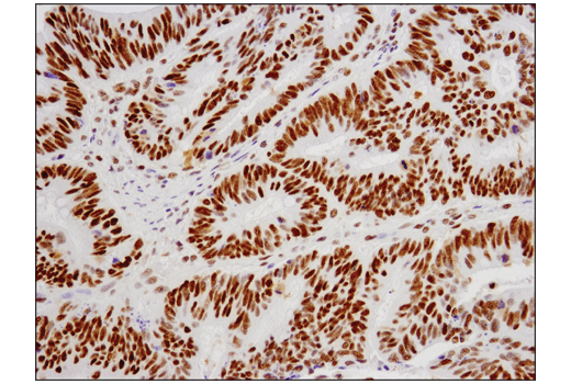 Immunohistochemistry Image 1: ESET (D4M8R) XP® Rabbit mAb