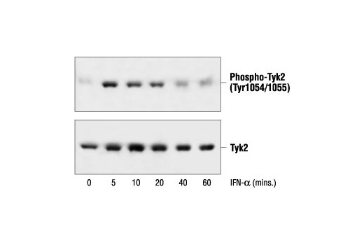 Western Blotting Image 1: Phospho-Tyk2 (Tyr1054/1055) Antibody