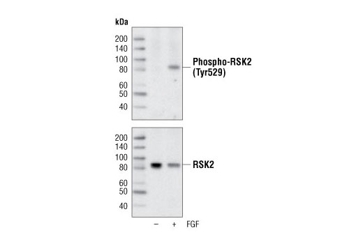 Western Blotting Image 1: Phospho-RSK2 (Tyr529) Antibody