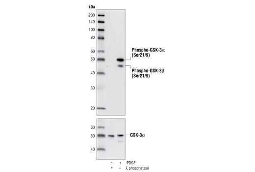 Phospho-GSK-3α/β (Ser21/9) (37F11) Rabbit mAb (GSK-3α Preferred 
