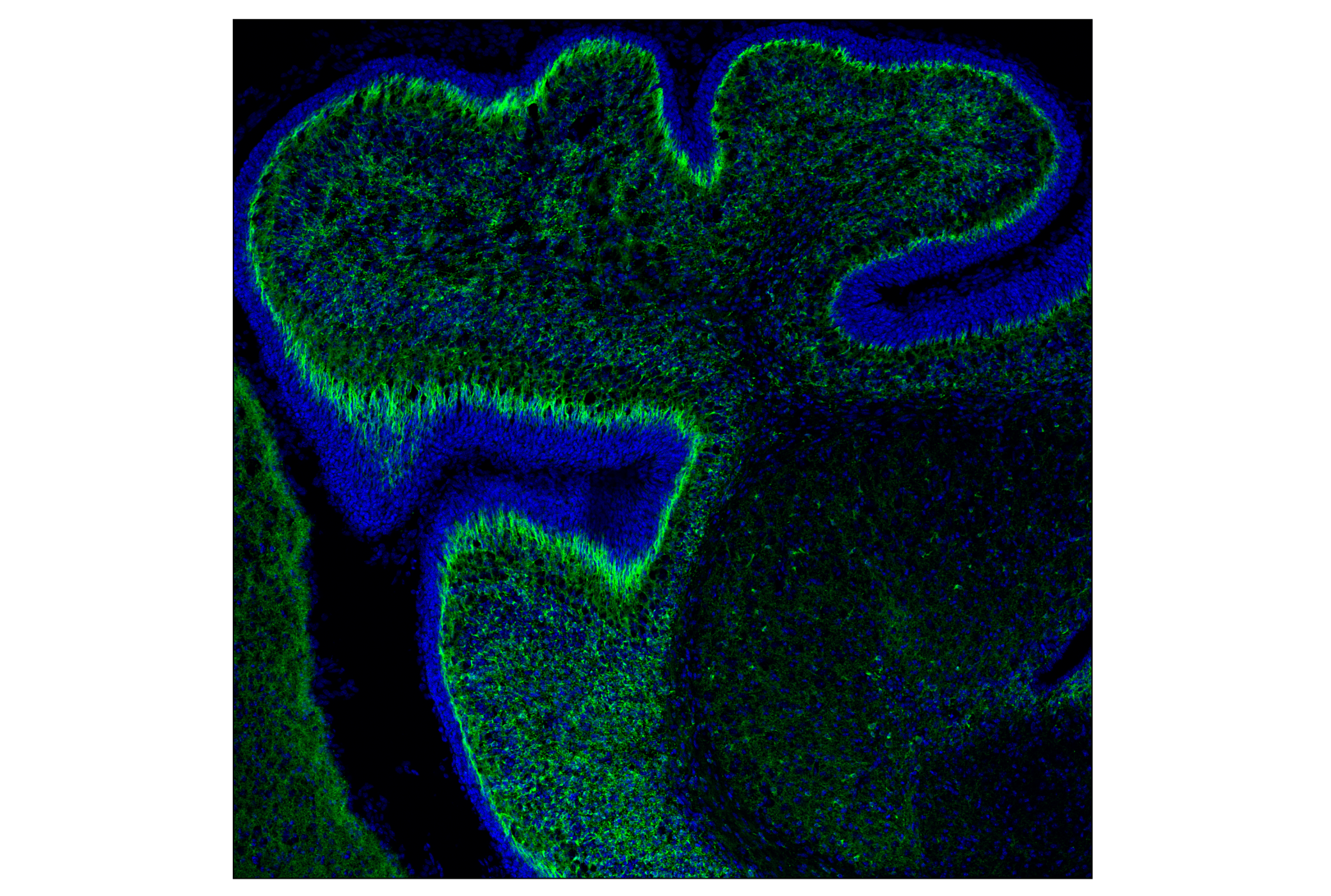 Immunofluorescence Image 2: Doublecortin (F6K9E) Rabbit mAb (Alexa Fluor® 488 Conjugate)