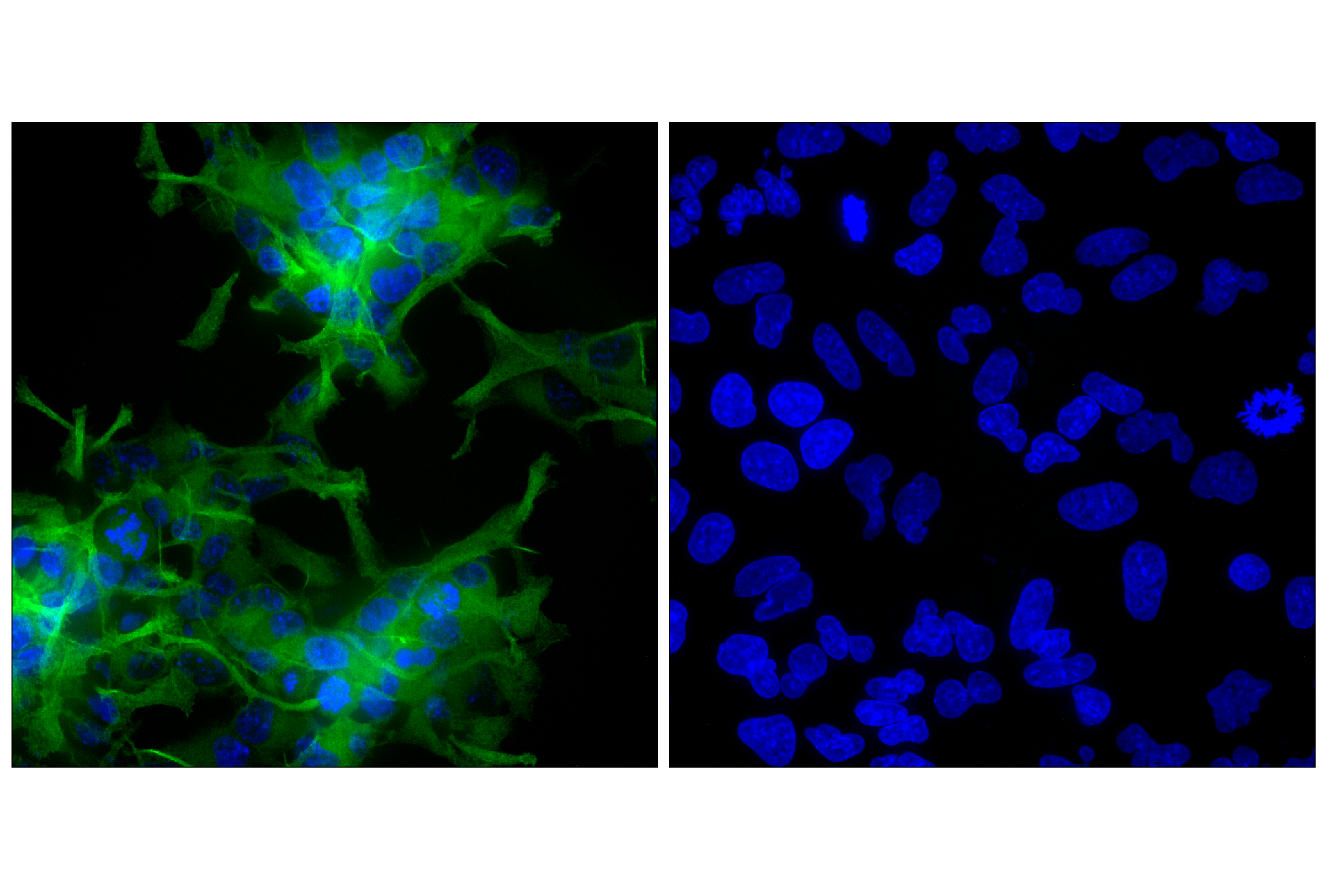 Immunofluorescence Image 3: Doublecortin (F6K9E) Rabbit mAb (Alexa Fluor® 488 Conjugate)