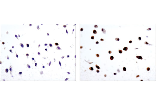 Immunohistochemistry Image 3: Phospho-p90RSK (Ser380) (D3H11) Rabbit mAb (BSA and Azide Free)