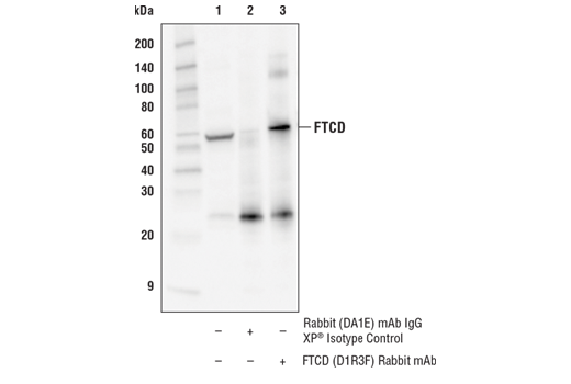 Immunoprecipitation Image 1: FTCD (D1R3F) Rabbit mAb