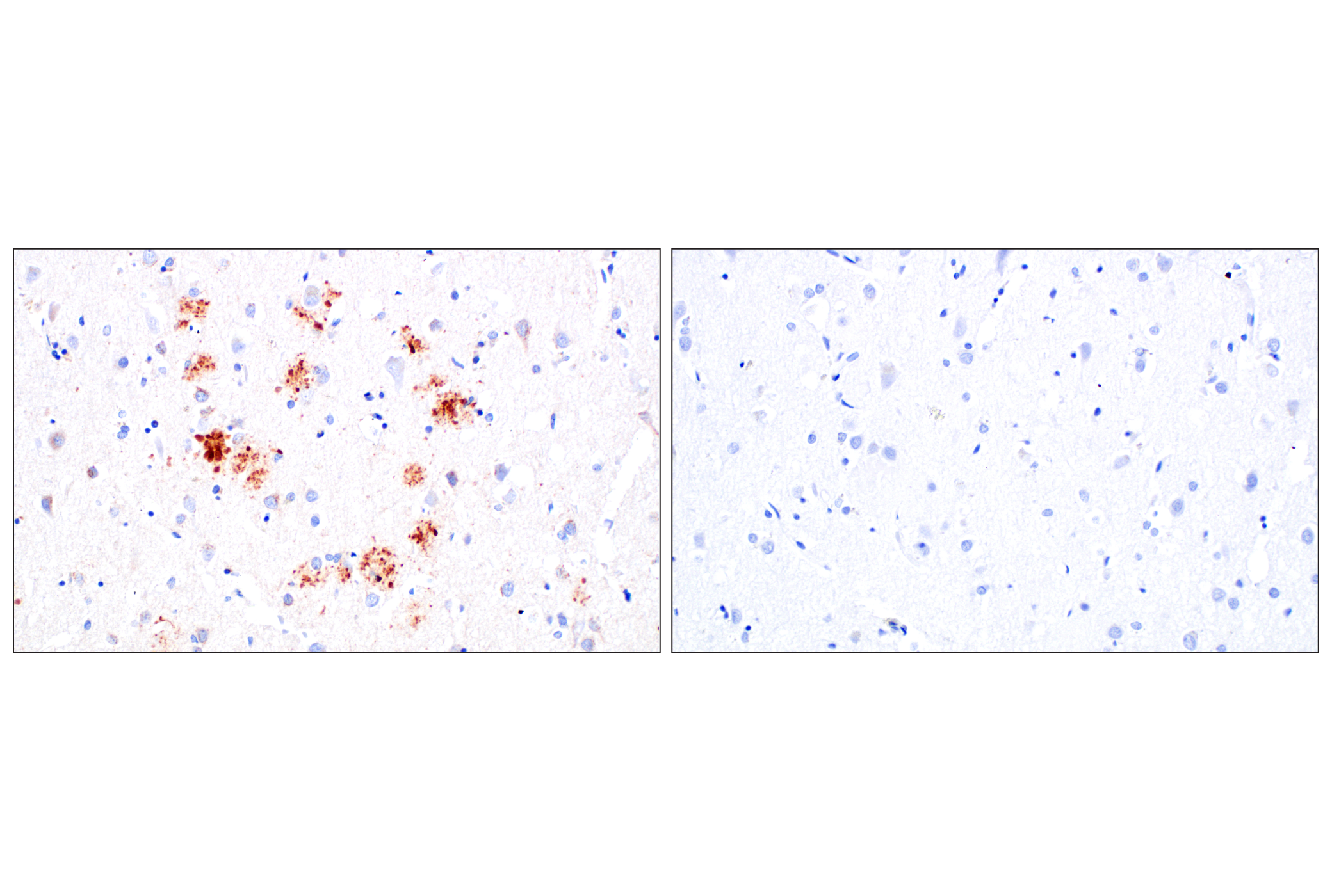 Immunohistochemistry Image 8: TMEM106B (E7H7Z) Rabbit Monoclonal Antibody