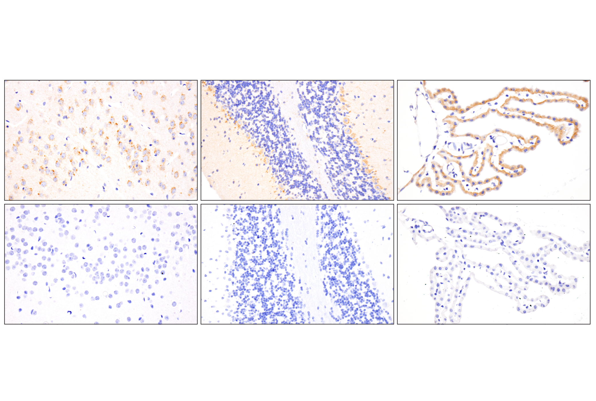 Immunohistochemistry Image 3: TMEM106B (E7H7Z) Rabbit Monoclonal Antibody