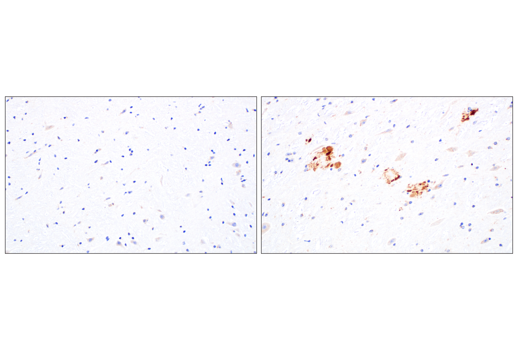 Immunohistochemistry Image 4: TMEM106B (E7H7Z) Rabbit Monoclonal Antibody