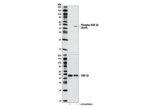 Western Blotting Image 1: Phospho-GSK-3β (Ser9) Antibody