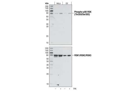 Western Blotting Image 1: Phospho-p90RSK (Thr359/Ser363) Antibody