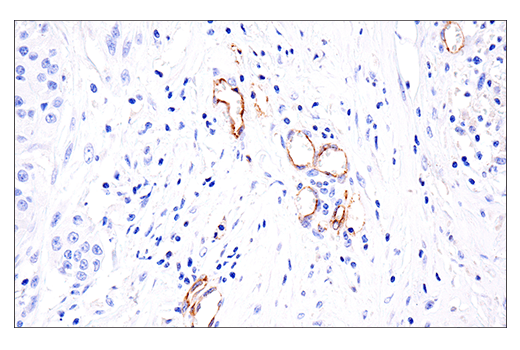 Immunohistochemistry Image 2: VE-Cadherin (E6N7A) Rabbit mAb