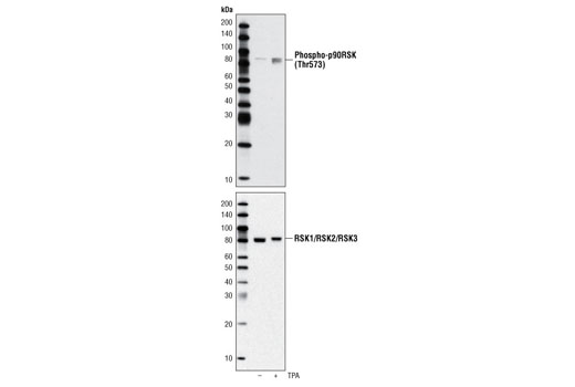 Western Blotting Image 1: Phospho-p90RSK (Thr573) Antibody