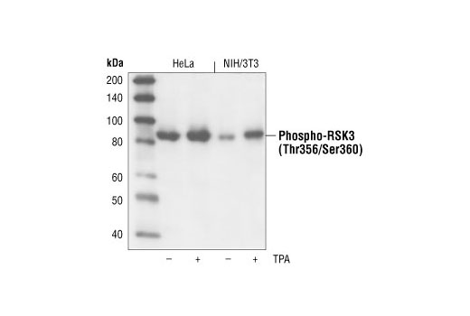 Western Blotting Image 1: Phospho-RSK3 (Thr356/Ser360) Antibody