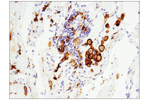 Immunohistochemistry Image 1: CD163 (D6U1J) Rabbit mAb