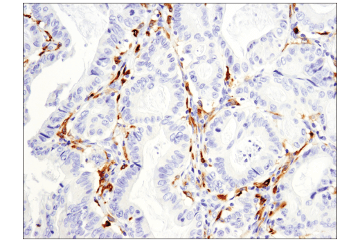 Immunohistochemistry Image 3: CD163 (D6U1J) Rabbit mAb