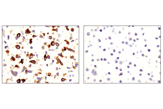 Immunohistochemistry Image 8: CD163 (D6U1J) Rabbit mAb