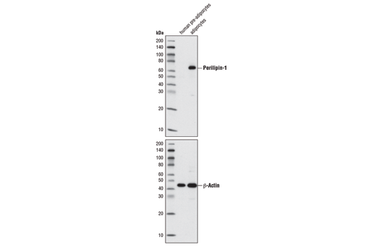 Image 8: Adipogenesis Marker Antibody Sampler Kit