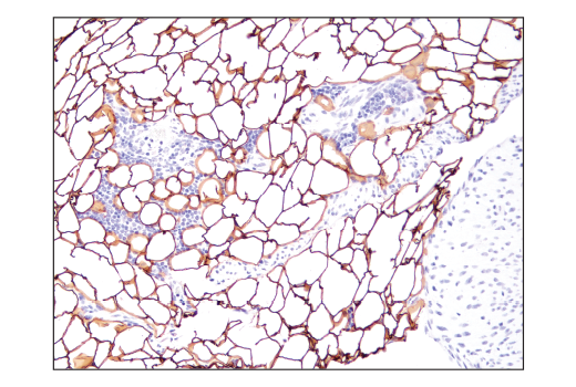  Image 35: Adipogenesis Marker Antibody Sampler Kit