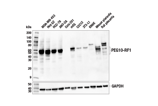 Western Blotting Image 1: PEG10-RF1 Antibody