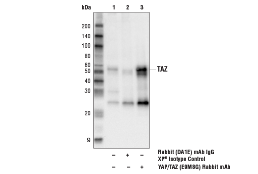 Immunoprecipitation Image 2: YAP/TAZ (E9M8G) Rabbit mAb