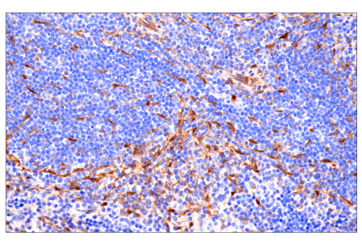 Immunohistochemistry Image 11: YAP/TAZ (E9M8G) Rabbit mAb