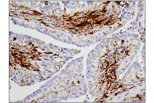 Immunohistochemistry Image 1: Legumain (D6S4H) Rabbit mAb (BSA and Azide Free)