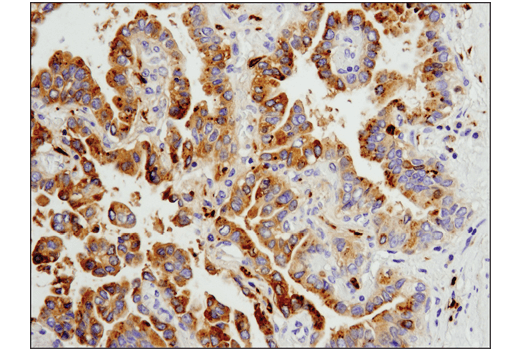 Immunohistochemistry Image 3: Legumain (D6S4H) Rabbit mAb (BSA and Azide Free)