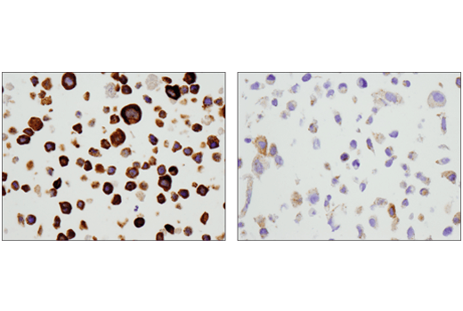 Immunohistochemistry Image 4: Legumain (D6S4H) Rabbit mAb (BSA and Azide Free)