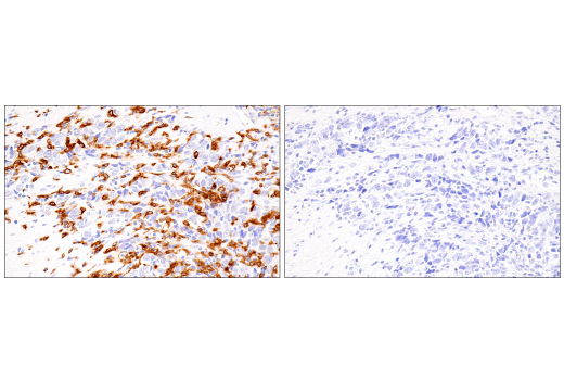 Immunohistochemistry Image 10: DAP12 (E8P9U) Rabbit mAb (BSA and Azide Free)