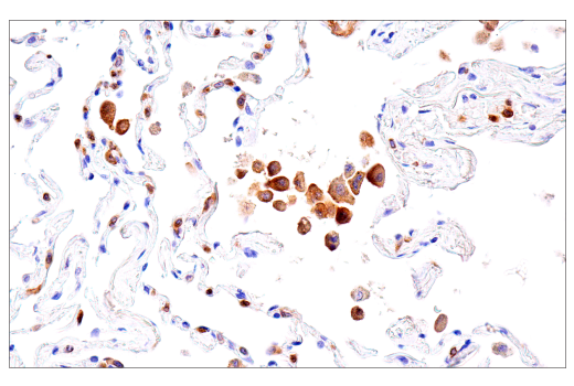 Immunohistochemistry Image 8: DAP12 (E8P9U) Rabbit mAb (BSA and Azide Free)