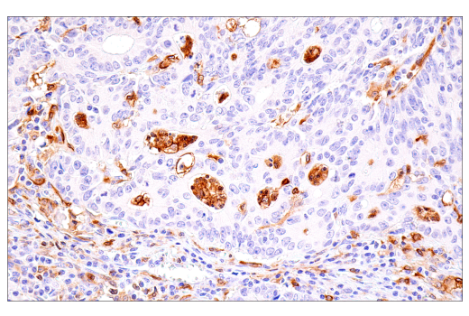 Immunohistochemistry Image 4: DAP12 (E8P9U) Rabbit mAb (BSA and Azide Free)