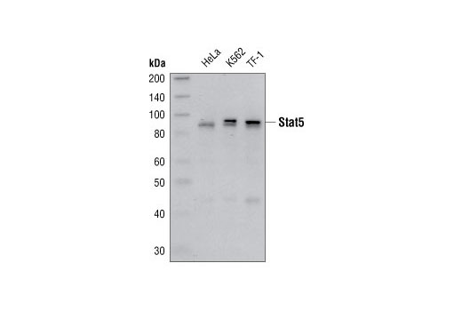 Western Blotting Image 1: Stat5 Antibody