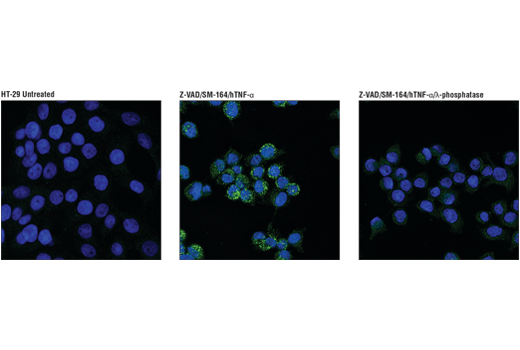 Immunofluorescence Image 1: Phospho-RIP3 (Ser227) (D6W2T) Rabbit mAb