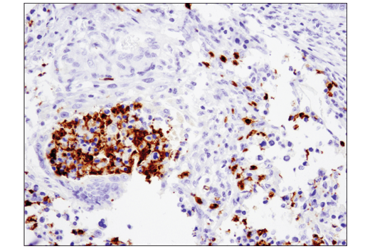  Image 24: Mouse Reactive M1 vs M2 Macrophage IHC Antibody Sampler Kit