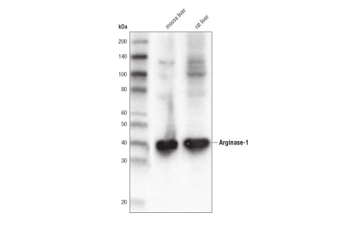  Image 12: Mouse Reactive M1 vs M2 Macrophage IHC Antibody Sampler Kit